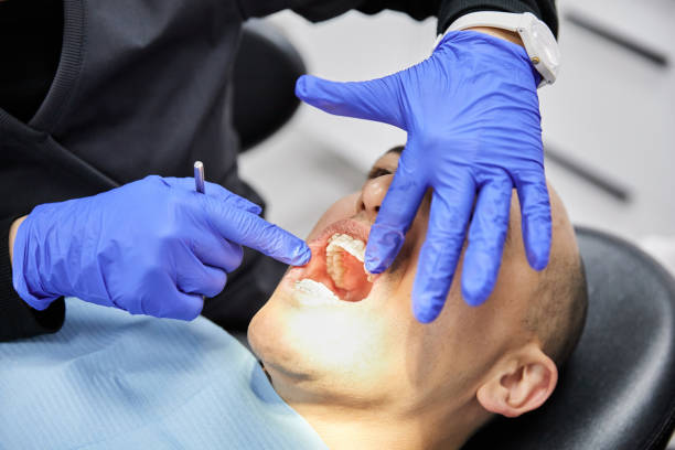 Best Broken or Chipped Tooth Repair in Shrewsbury, NJ
